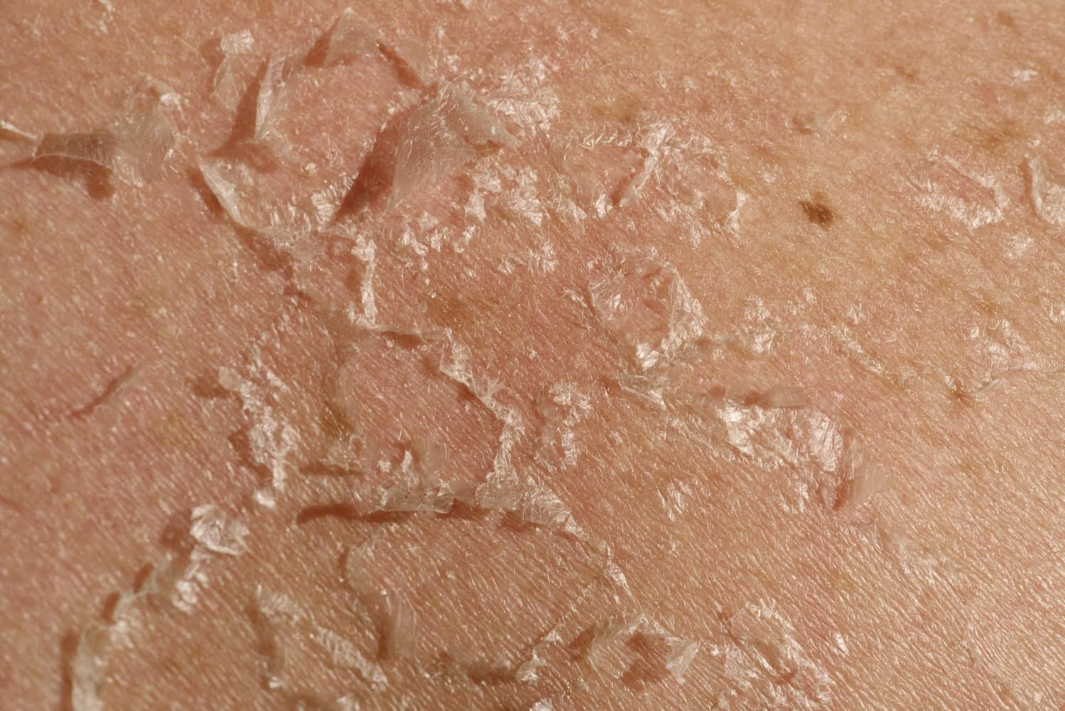 How Exfoliation Boost Your Skincare Routine