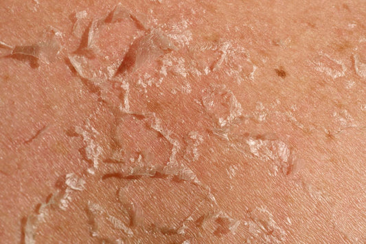 How Exfoliation Boost Your Skincare Routine